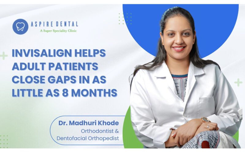 Invisalign Treatment Delivers Predictable Results for Adult Patients, Achieving Complete Space Closure in as Little as 8 Months